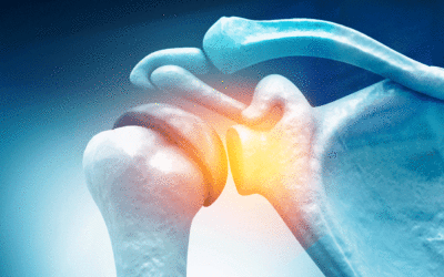 Louisiana Orthopedic Surgeon Publishes and Presents Regenerative Research on Osteoarthritis
